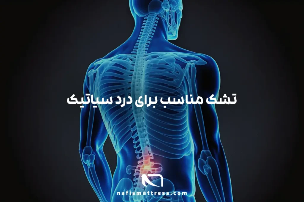 تشک مناسب سیاتیک